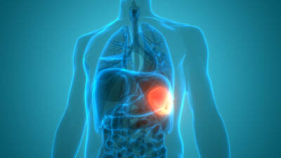 Living with spleen problems or without a spleen - Immunodeficiency UK